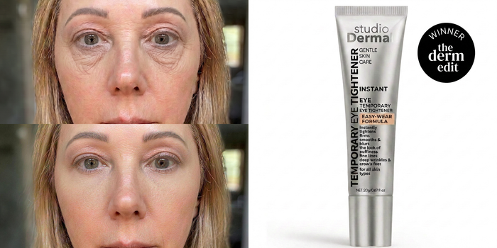Before and after comparison next to the eye tightener tube