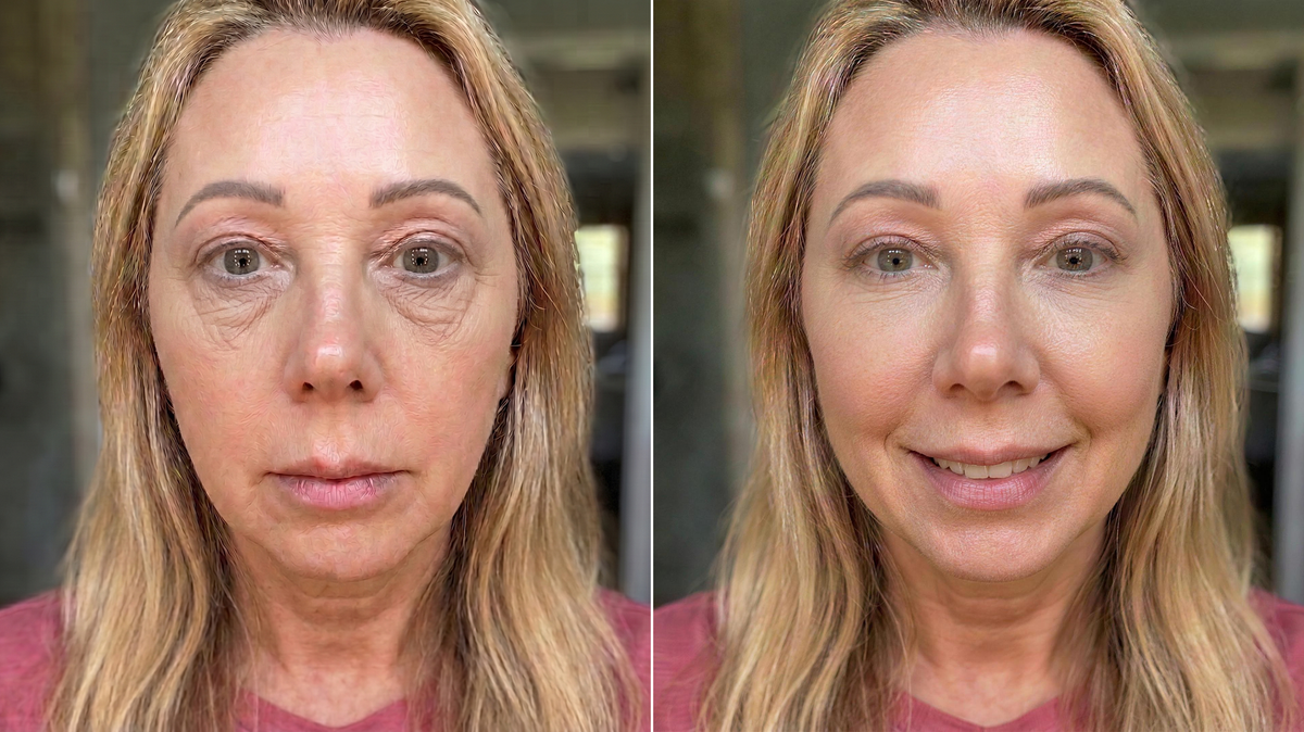 Split comparison showing how an under-eye bag changes how old a face reads